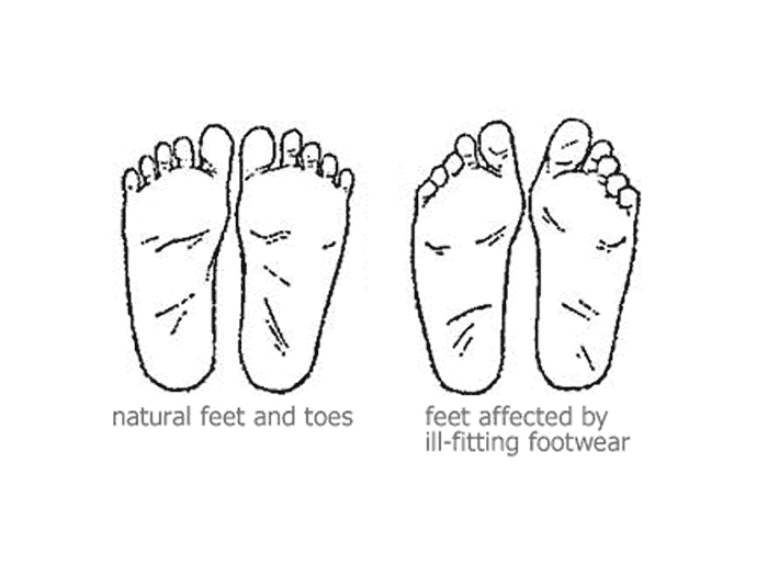 cure-foot-problems-naturally