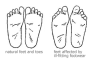 cure-foot-problems-naturally