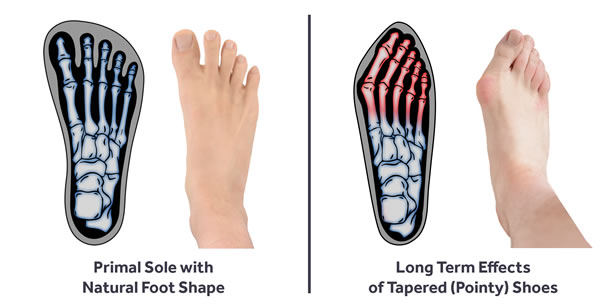 Primal Sole Shape Comparison