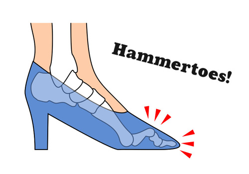 shoes for women with hammer toes