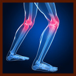 Knee Arthritis? Change Your Shoes for Prevention and Treatment