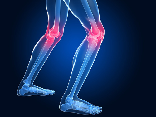 Are Your Shoes to Blame for Your Knee Pain?: John S. Michels, MD:  Interventional Pain Management