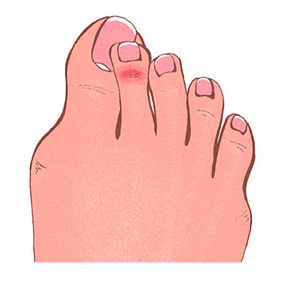 Drawing of Overlapping Toes