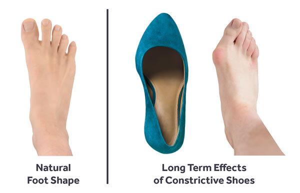 Foot Shape Comparison