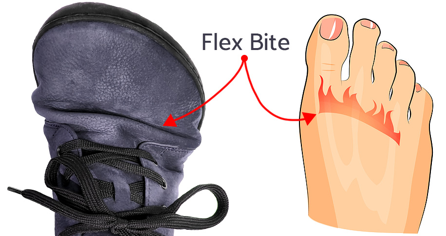 Example of Flex Bite across forefoot